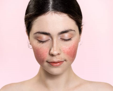 Cremas Necesidades Especiales